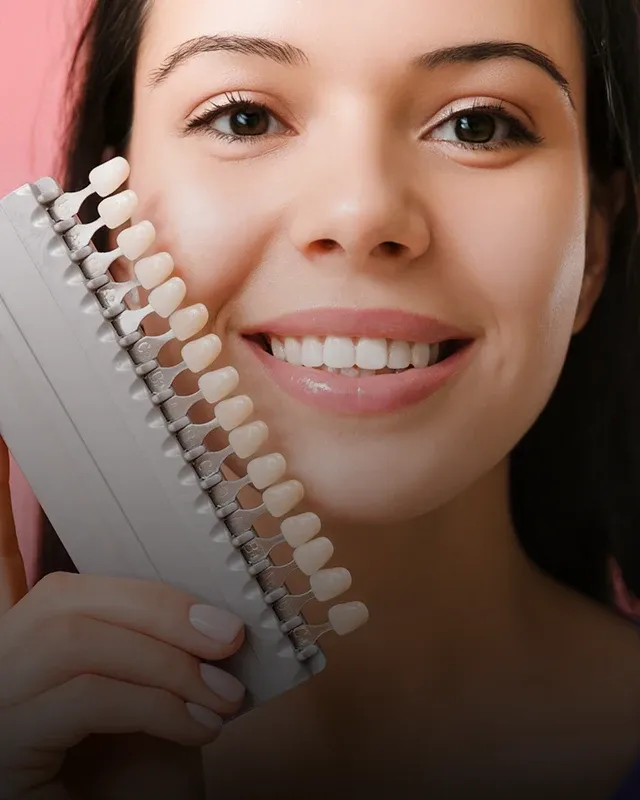 A female patient holding a teeth whitening color palette up to her face